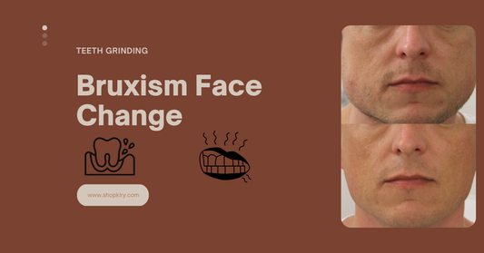 Bruxism Face Change: Understanding the Impact of Teeth Grinding