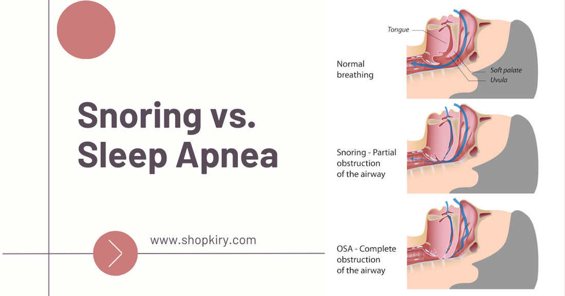 Snoring vs. Sleep Apnea: What's the Difference?