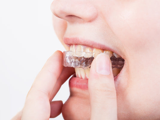 Understanding Teeth Retainers